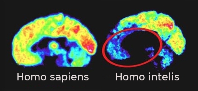 Мозок людини (зліва) і мозок психопата (розмовляючої тварини)